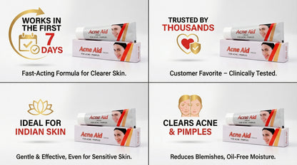 Acne Aid, Aloe Vera Cream (30 gm)