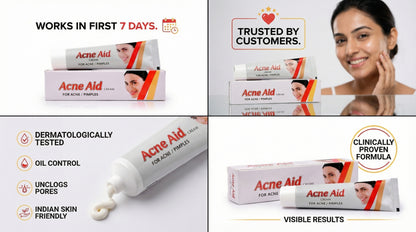 Acne Aid, Aloe Vera Cream (30 gm)